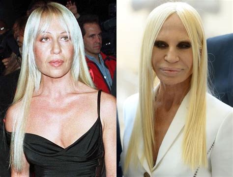 donatella versace english|donatella versace before and after surgery.